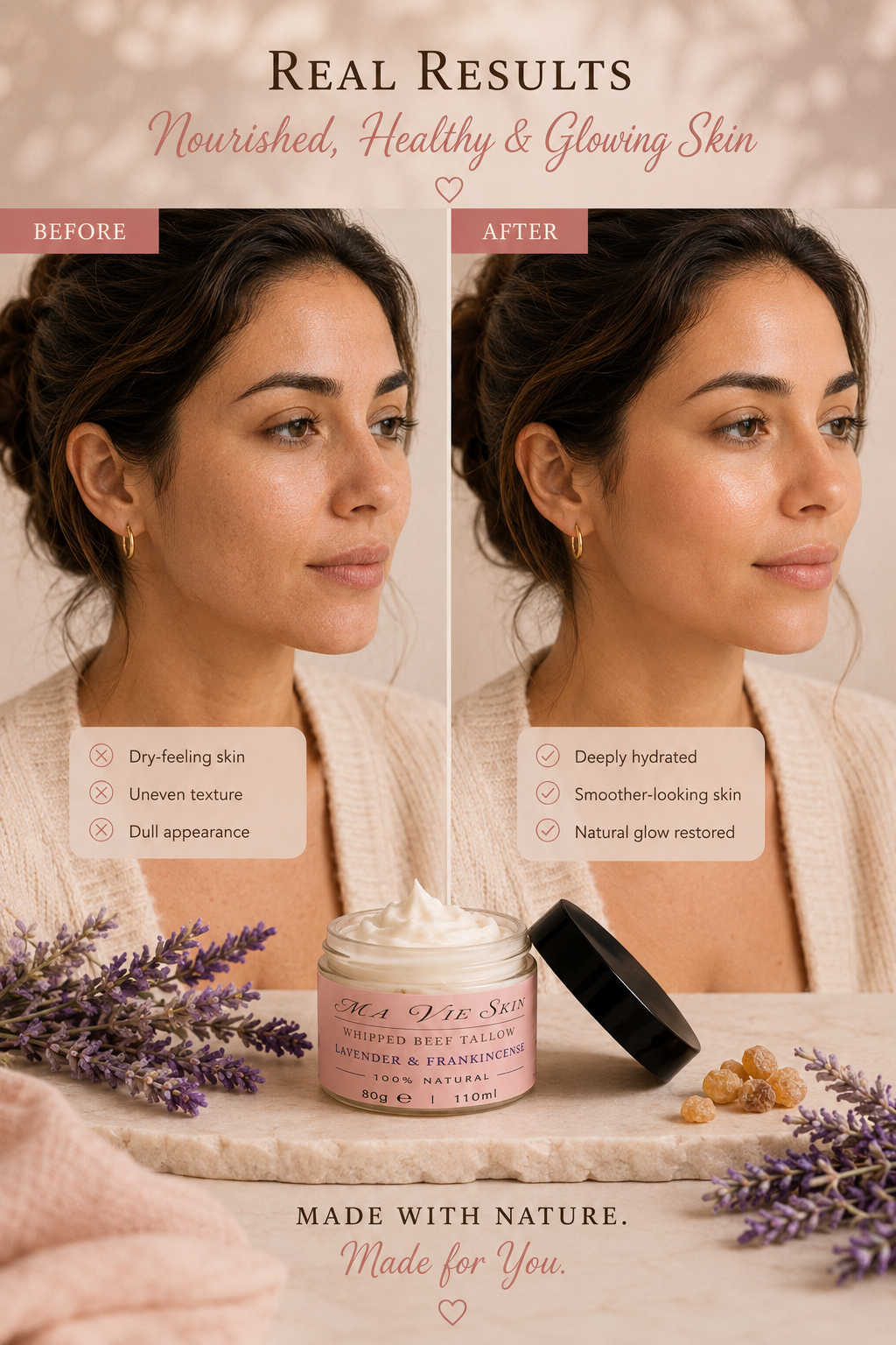 Ma Vie Skin Whipped Beef Tallow Cream – Lavender & Frankincense